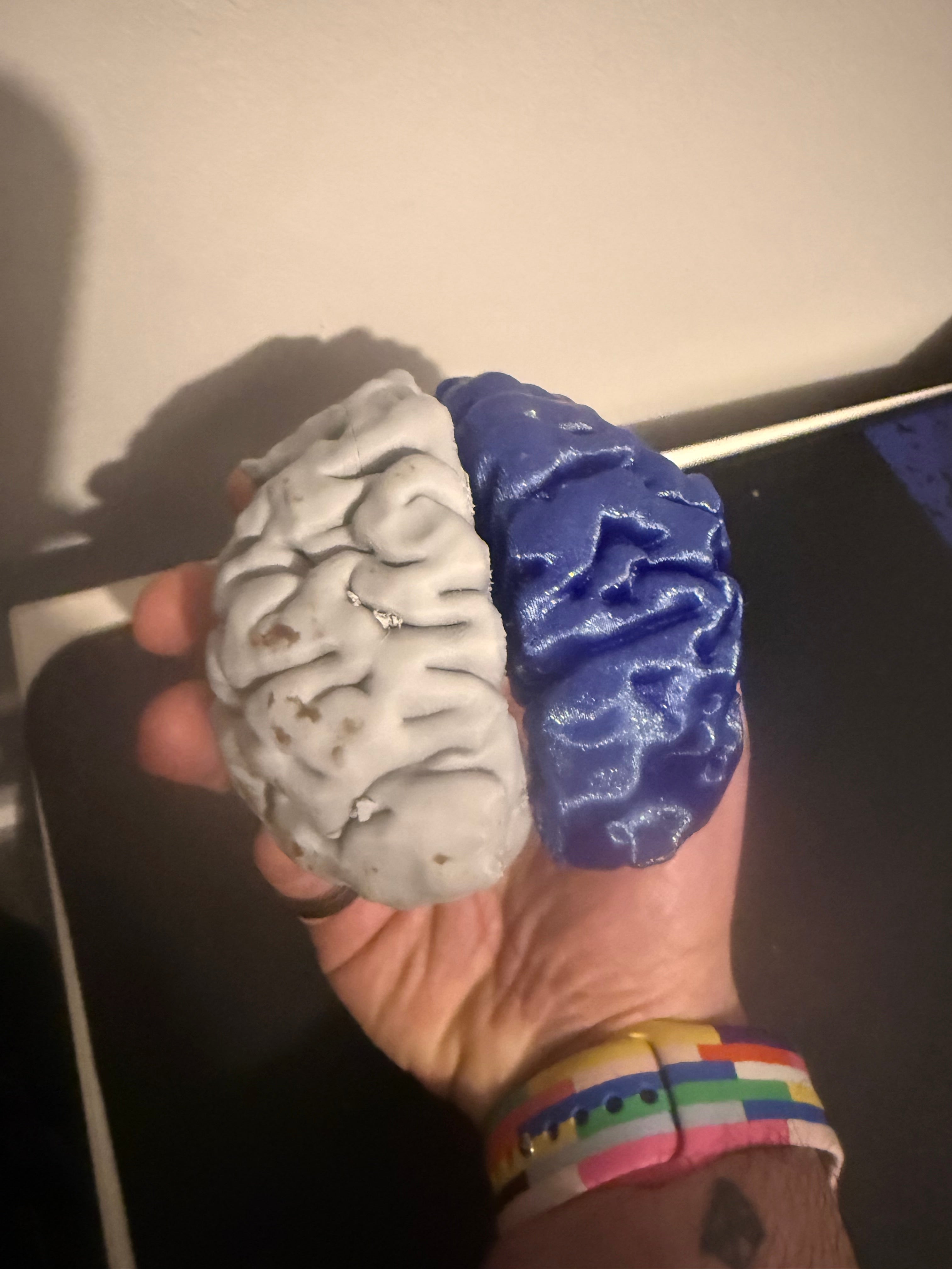 Custom 3D‑Printed Brain Model from MRI Scan